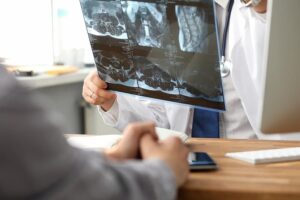 Soft Tissue Injuries That Result From Accidents
