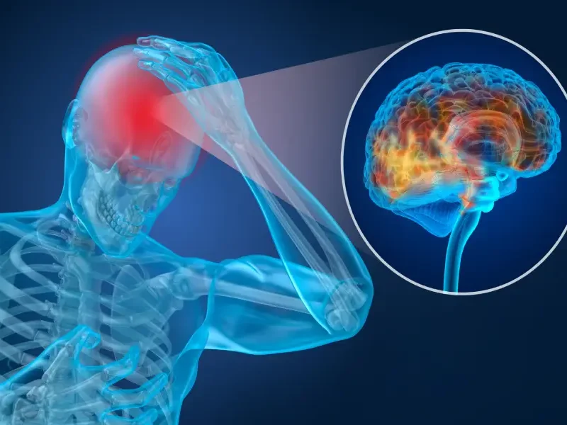Can I Seek Compensation for Mild Concussion Symptoms?