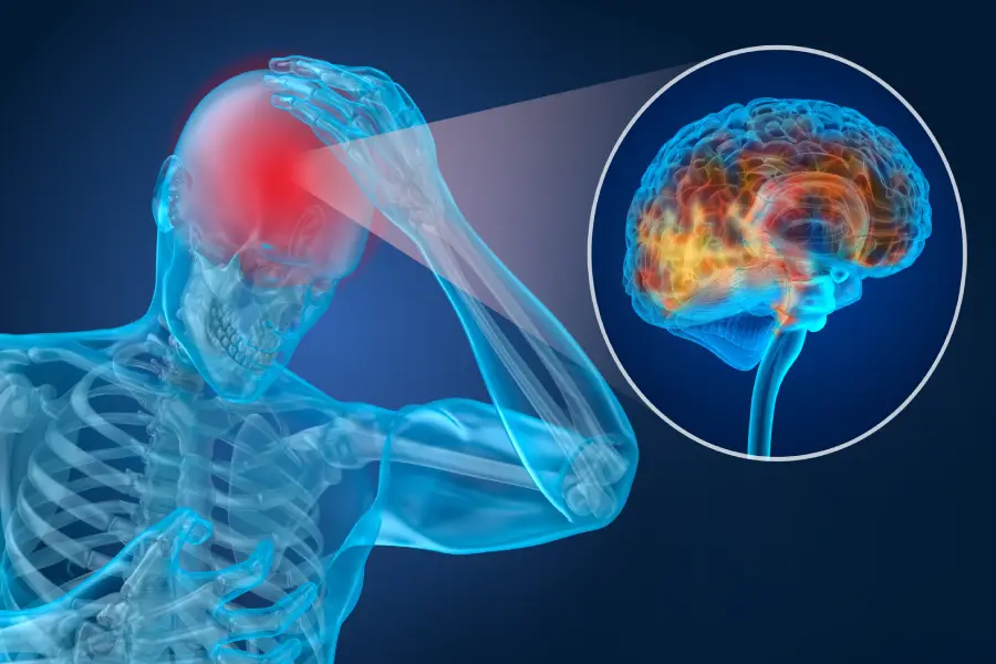 Can I Seek Compensation for Mild Concussion Symptoms?