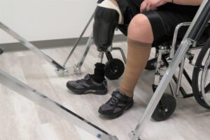 Paciente con lesiones catastróficas tras un accidente de tráfico 